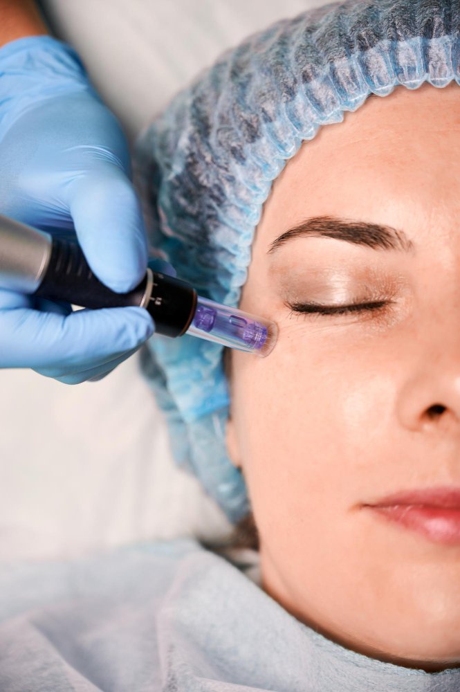 dermapen facial un tratamiento de Dermapen en un lugar de Manizales