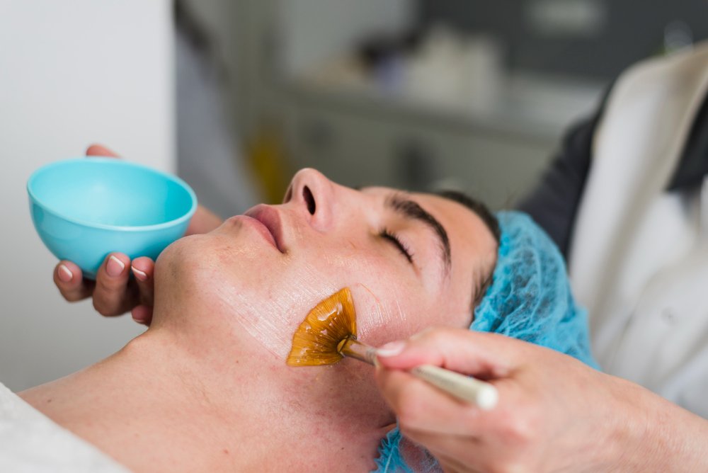 peeling de aclamiento facial e íntimo peeling de aclaramiento facial con ubicacion en manizales